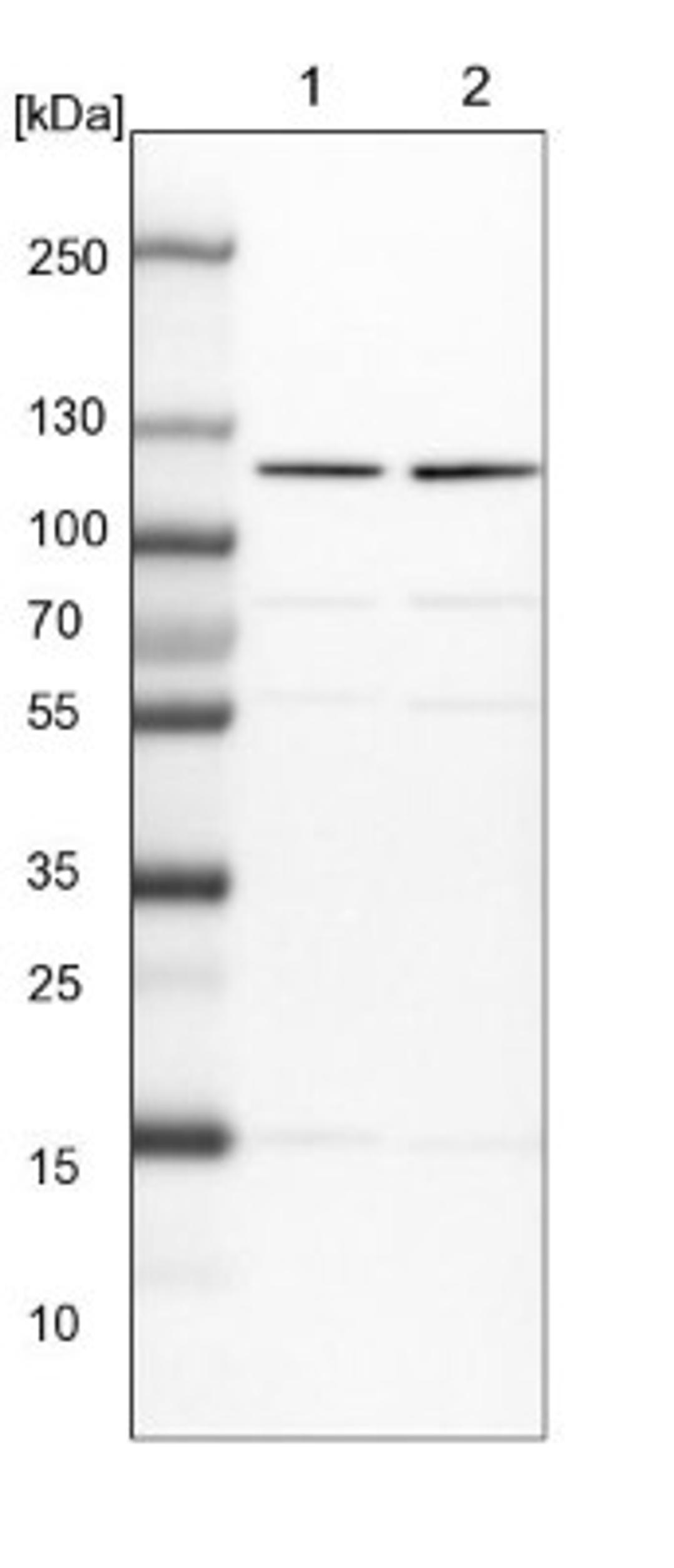 Western Blot: CASZ1 Antibody [NBP1-86618] - Lane 1: NIH-3T3 cell lysate (Mouse embryonic fibroblast cells)<br/>Lane 2: NBT-II cell lysate (Rat Wistar bladder tumour cells)