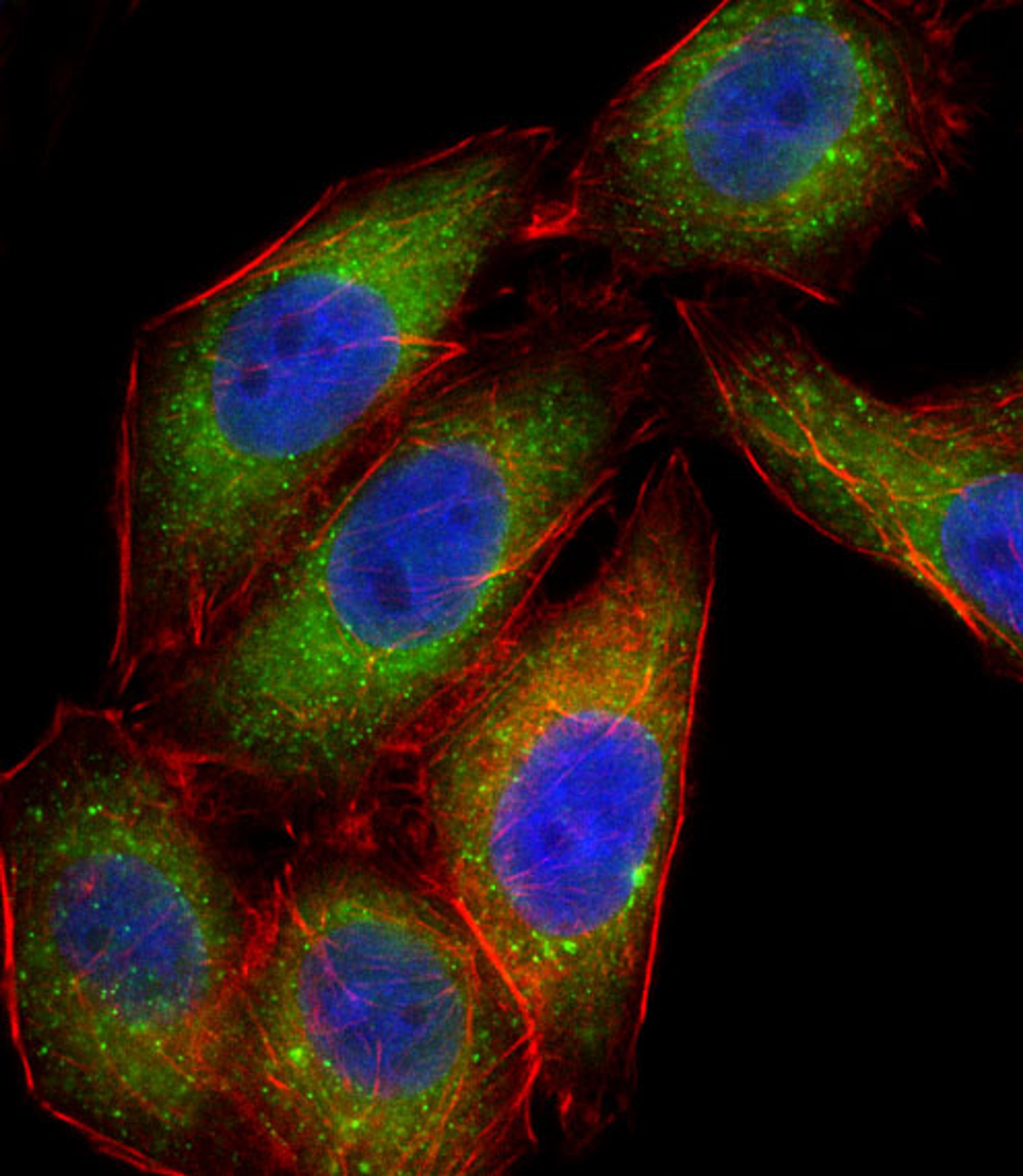 Fluorescent confocal image of A549 cell stained with MAPK14 Antibody (Center T180/Y182).A549 cells were fixed with 4% PFA (20 min), permeabilized with Triton X-100 (0.1%, 10 min), then incubated with MAPK14 primary antibody (1:25). For secondary antibody,