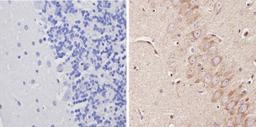 Immunohistochemistry-Paraffin: Adenosine A1 R Antibody [NB300-549] - Analysis showing positive staining in the cytoplasm of Rat brain tissue (right) compared with a negative control in the absence of primary antibody (left).