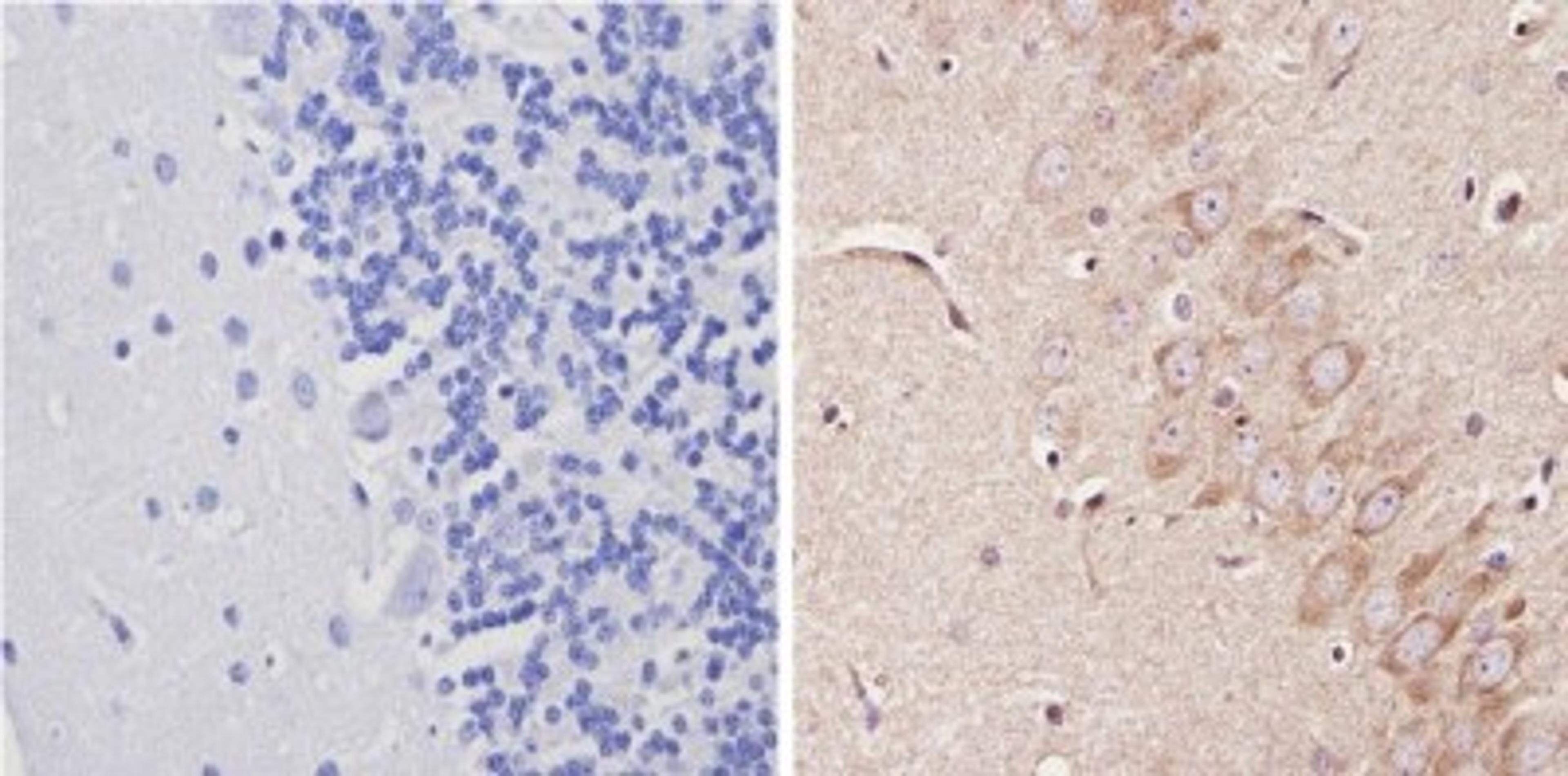 Immunohistochemistry-Paraffin: Adenosine A1 R Antibody [NB300-549] - Analysis showing positive staining in the cytoplasm of Rat brain tissue (right) compared with a negative control in the absence of primary antibody (left).