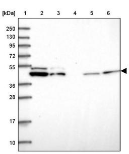 Western Blot: DDX49 Antibody [NBP2-47491] - Lane 1: Marker [kDa] 250, 130, 95, 72, 55, 36, 28, 17, 10.  Lane 2: Human cell line RT-4.  Lane 3: Human cell line U-251MG.  Lane 4: Human plasma (IgG/HSA depleted).  Lane 5: Human liver tissue.  Lane 6: Human tonsil tissue.