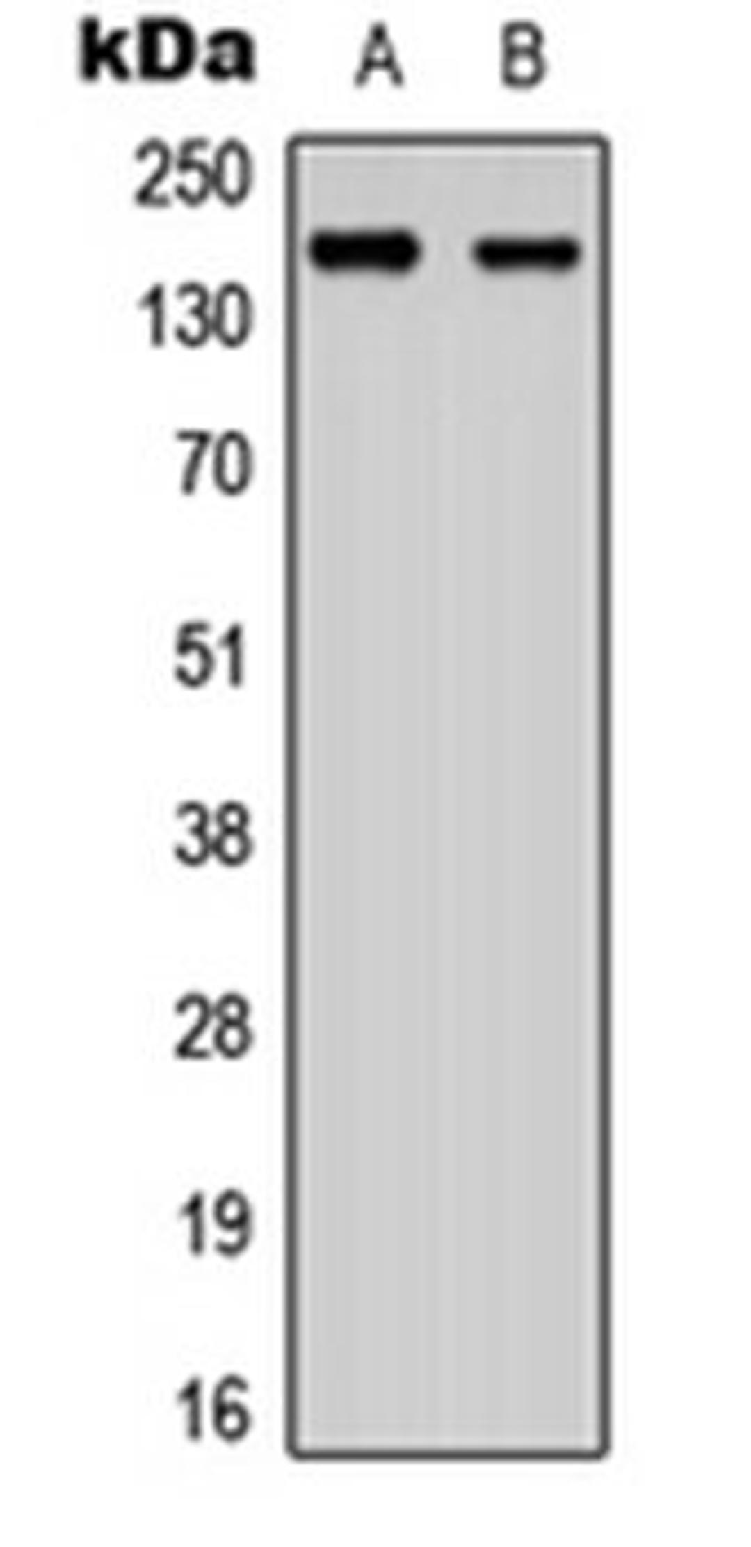 Western blot analysis of SHSY5Y (Lane 1), NIH3T3 (Lane 2) whole cell lysates using ANKRD30A antibody