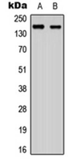 Western blot analysis of SHSY5Y (Lane 1), NIH3T3 (Lane 2) whole cell lysates using ANKRD30A antibody