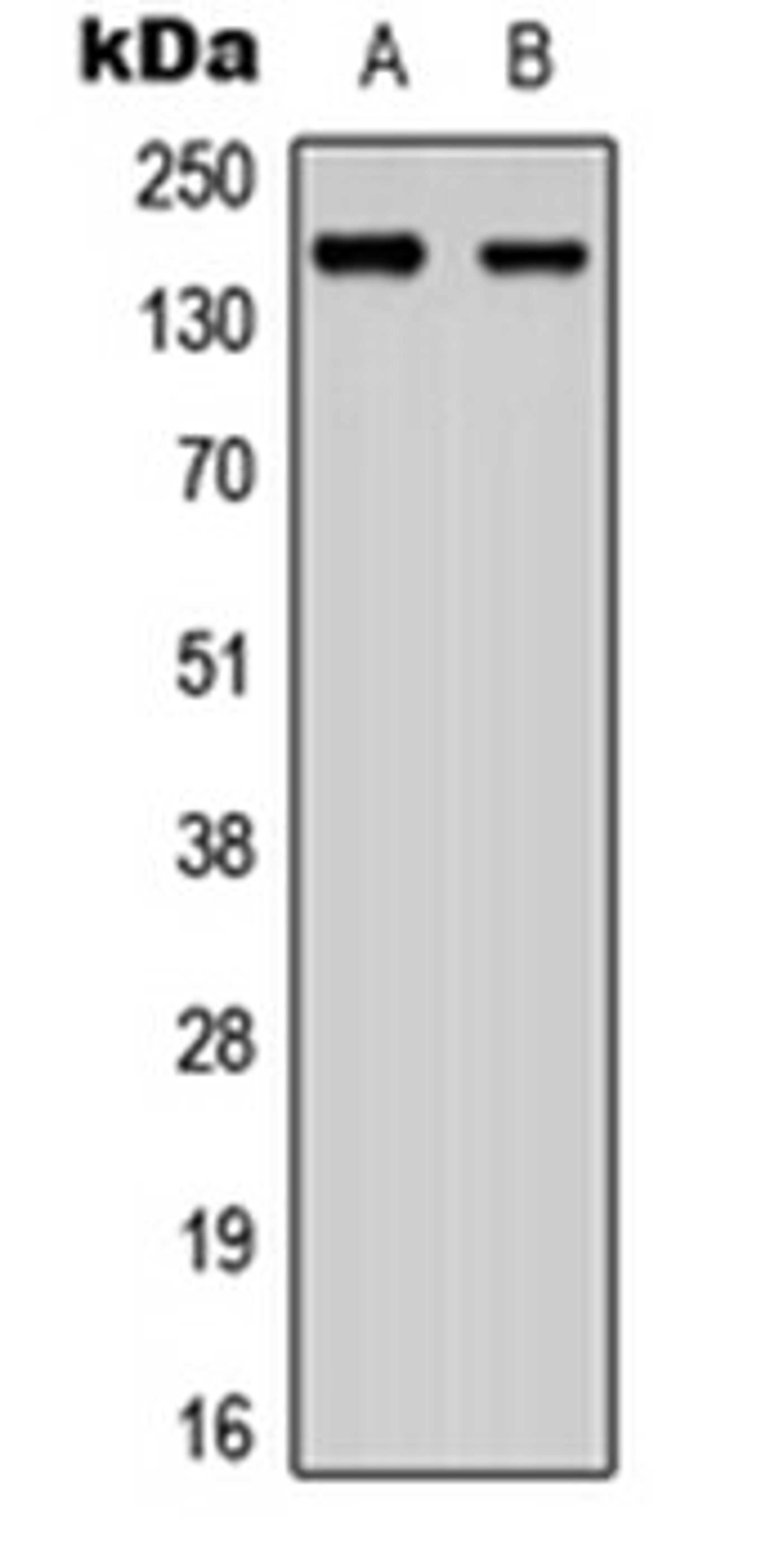 Western blot analysis of SHSY5Y (Lane 1), NIH3T3 (Lane 2) whole cell lysates using ANKRD30A antibody