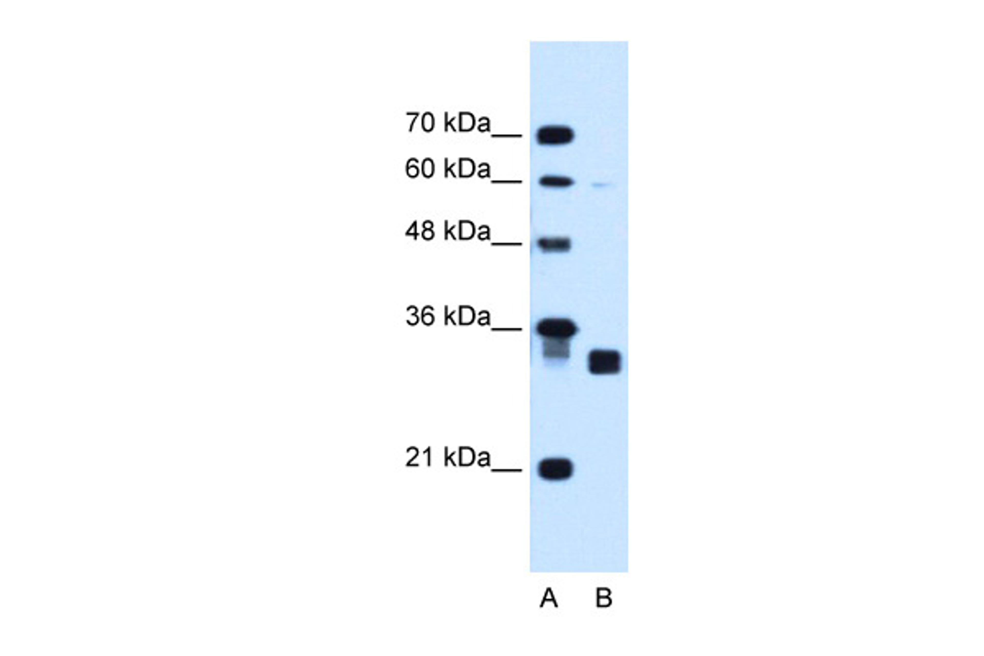 Antibody used in WB on Human HepG2 at 1.25 ug/ml.