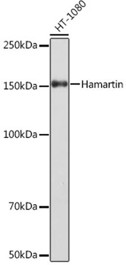 Western blot - Hamartin Rabbit mAb (A5121)