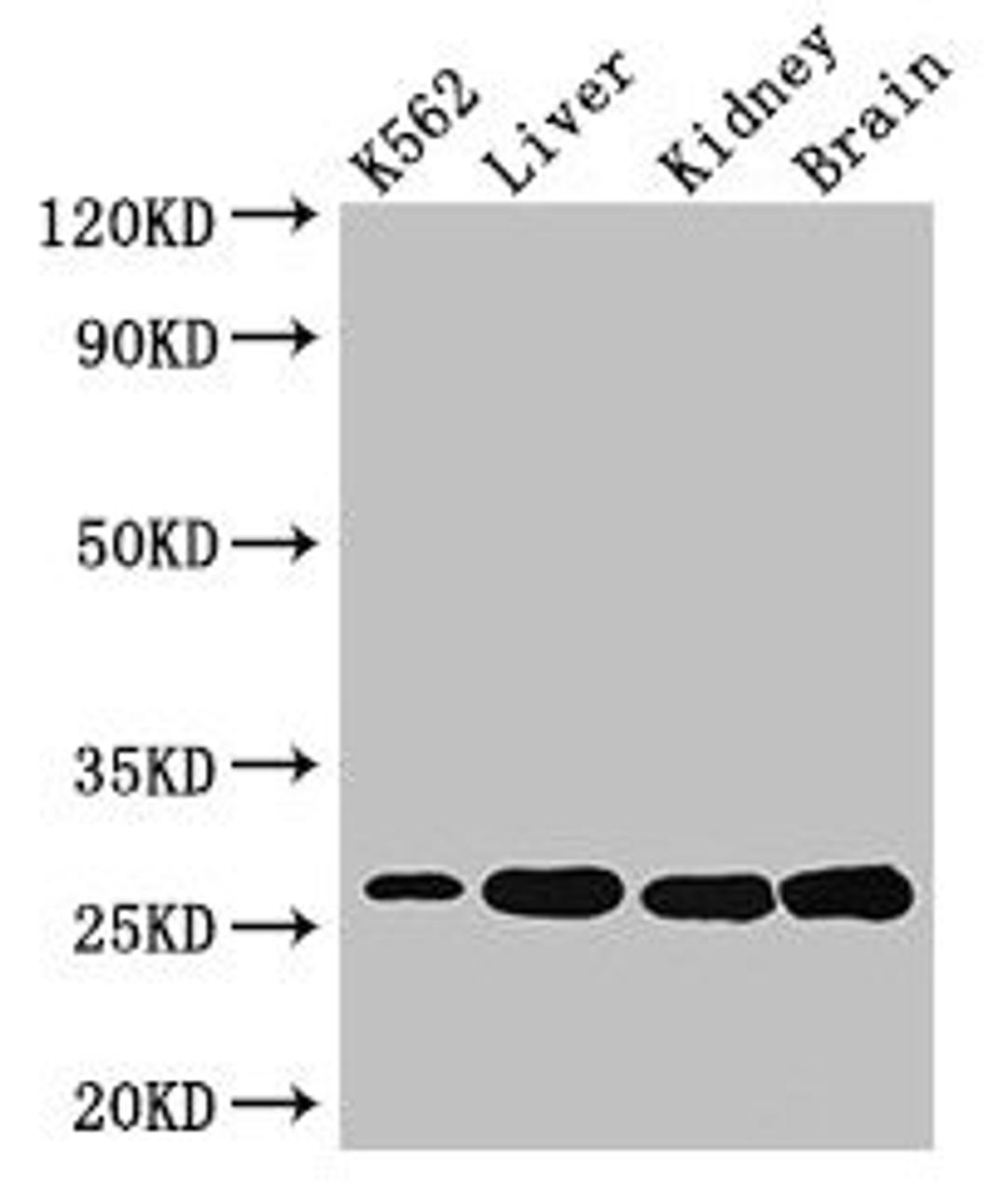 Western Blot. Positive WB detected in: K562 whole cell lysate, Mouse liver tissue, Mouse kidney tissue, Mouse brain tissue. All lanes: QDPR antibody at 3µg/ml. Secondary. Goat polyclonal to rabbit IgG at 1/50000 dilution. Predicted band size: 26, 23 kDa. Observed band size: 26 kDa