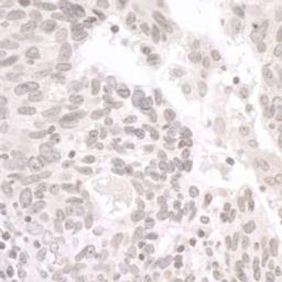 Detection of human PALB2 by immunohistochemistry.