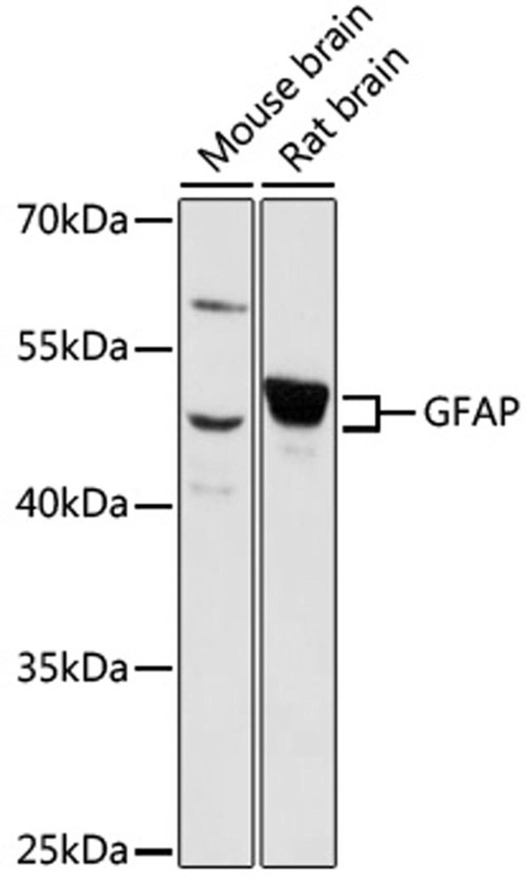 Western blot - GFAP antibody (A14673)