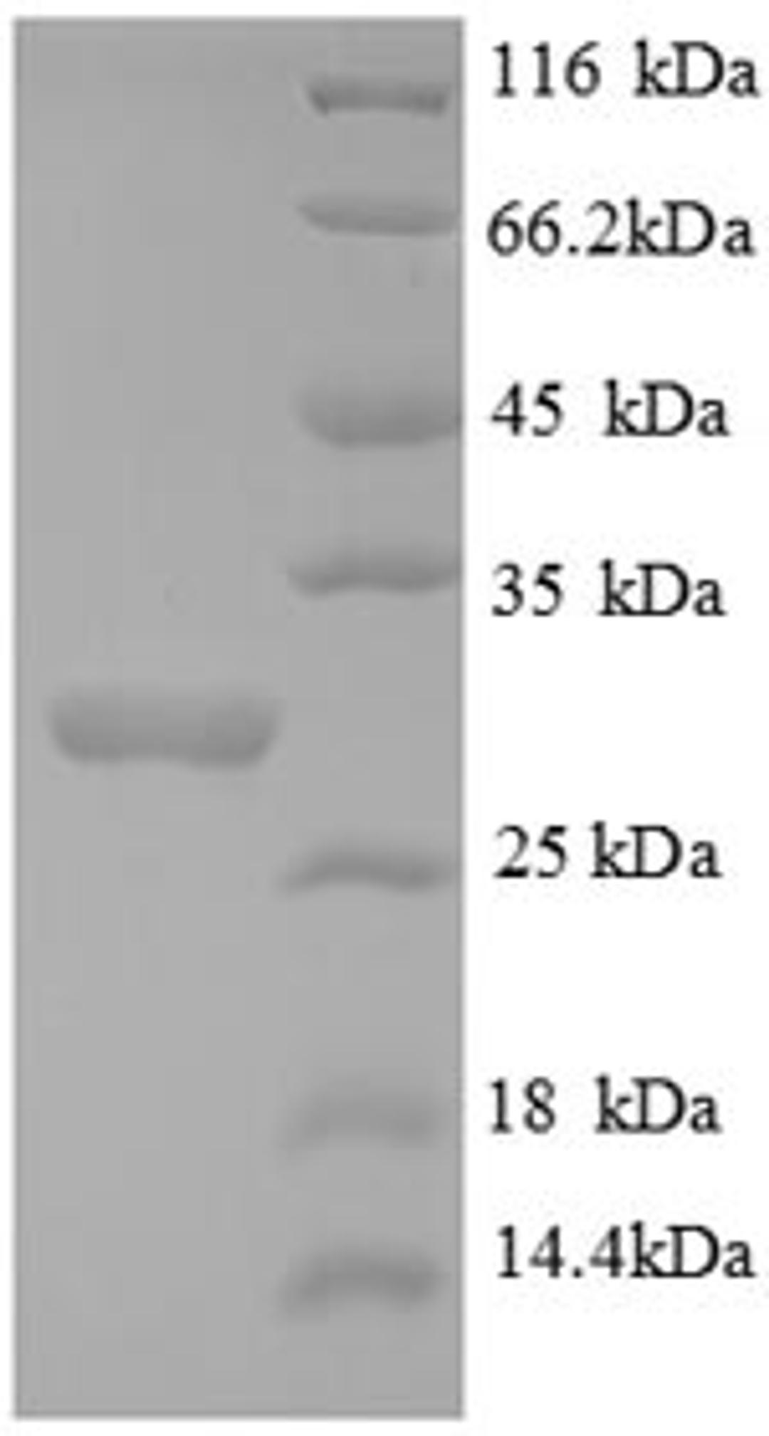 (Tris-Glycine gel) Discontinuous SDS-PAGE (reduced) with 5% enrichment gel and 15% separation gel.