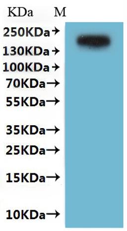 CSB-MP004927HU is detected by Mouse anti-GFP monoclonal antibody.