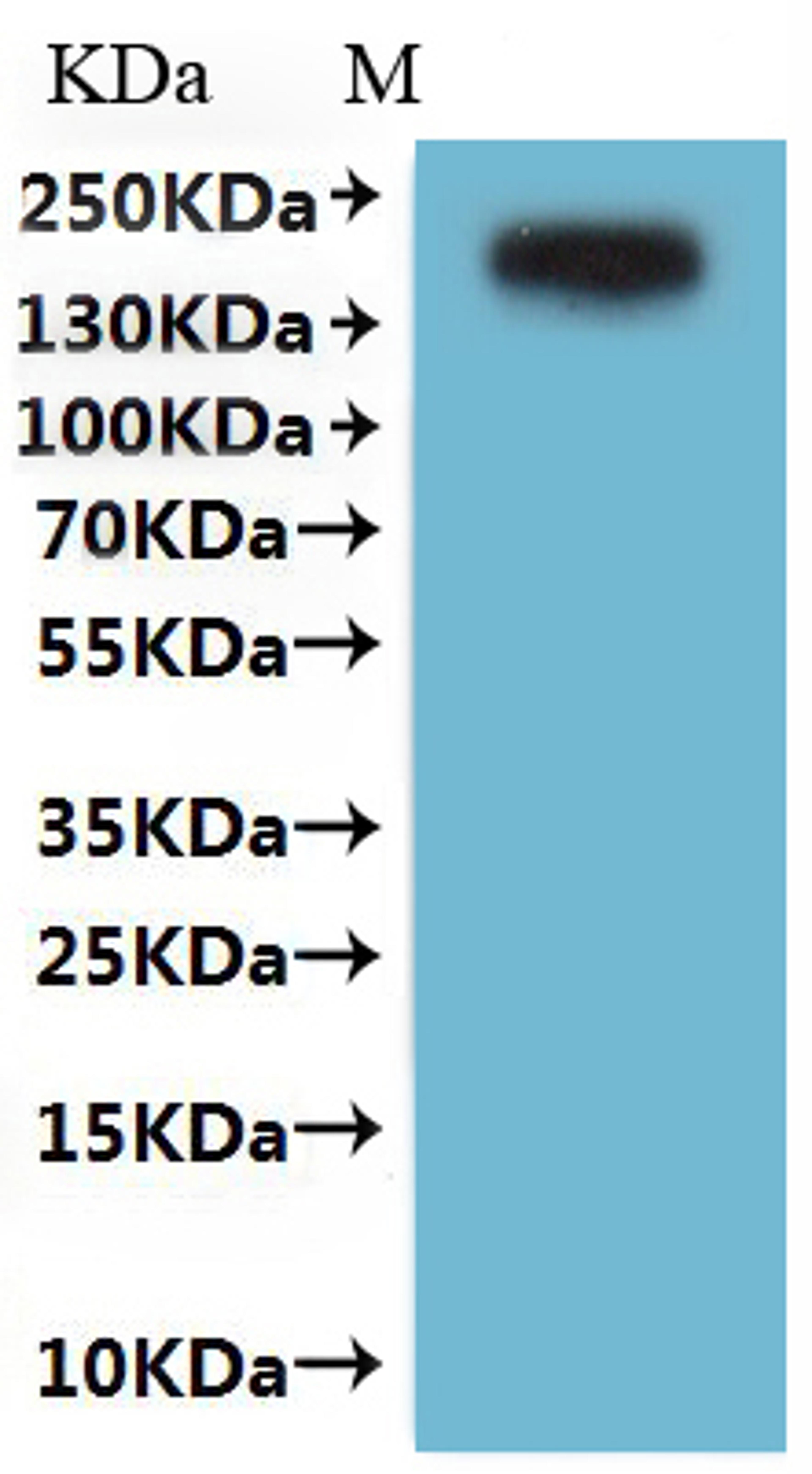 CSB-MP004927HU is detected by Mouse anti-GFP monoclonal antibody.
