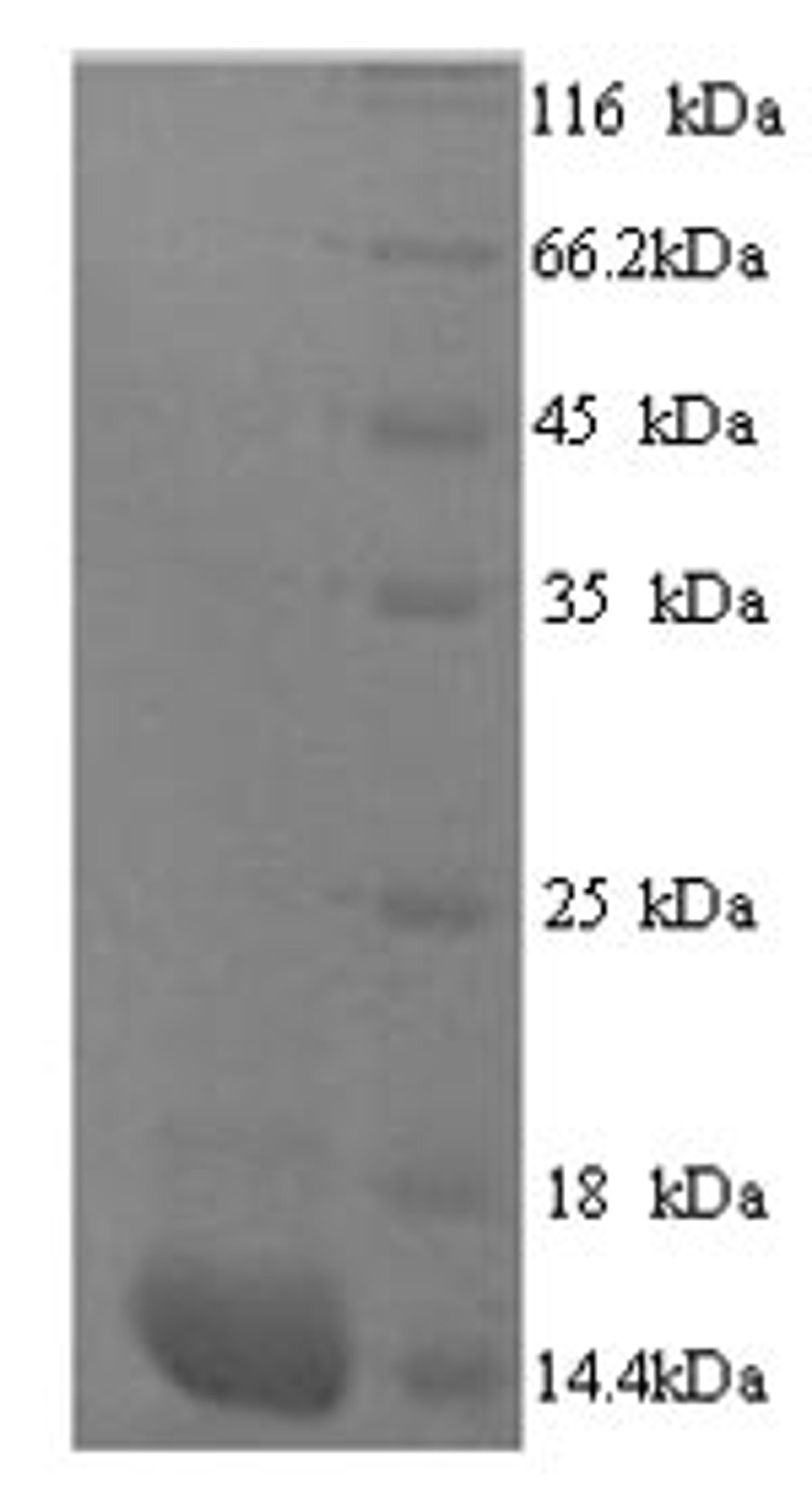 (Tris-Glycine gel) Discontinuous SDS-PAGE (reduced) with 5% enrichment gel and 15% separation gel.