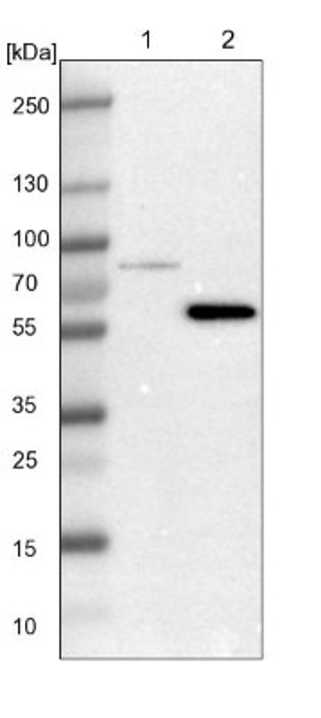 Western Blot: LIM kinase 2 Antibody [NBP1-85783] - Lane 1: NIH-3T3 cell lysate (Mouse embryonic fibroblast cells)<br/>Lane 2: NBT-II cell lysate (Rat Wistar bladder tumour cells)