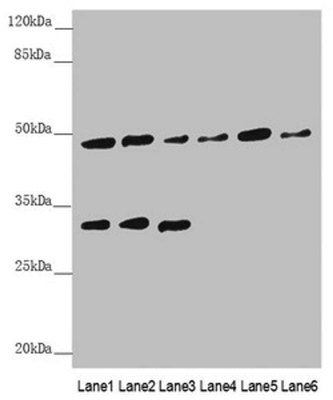 Western blot. All lanes: BCS1L antibody at 5.04 ug/ml. Lane 1: Mouse kidney tissue. Lane 2: Mouse liver tissue. Lane 3: Mouse brain tissue. Lane 4: A549 whole cell lysate. Lane 5: 293T whole cell lysate. Lane 6: Hela whole cell lysate. Secondary. Goat polyclonal to rabbit IgG at 1/10000 dilution. Predicted band size: 48 kDa. Observed band size: 48, 30 kDa. 