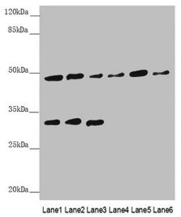 Western blot. All lanes: BCS1L antibody at 5.04 ug/ml. Lane 1: Mouse kidney tissue. Lane 2: Mouse liver tissue. Lane 3: Mouse brain tissue. Lane 4: A549 whole cell lysate. Lane 5: 293T whole cell lysate. Lane 6: Hela whole cell lysate. Secondary. Goat polyclonal to rabbit IgG at 1/10000 dilution. Predicted band size: 48 kDa. Observed band size: 48, 30 kDa. 