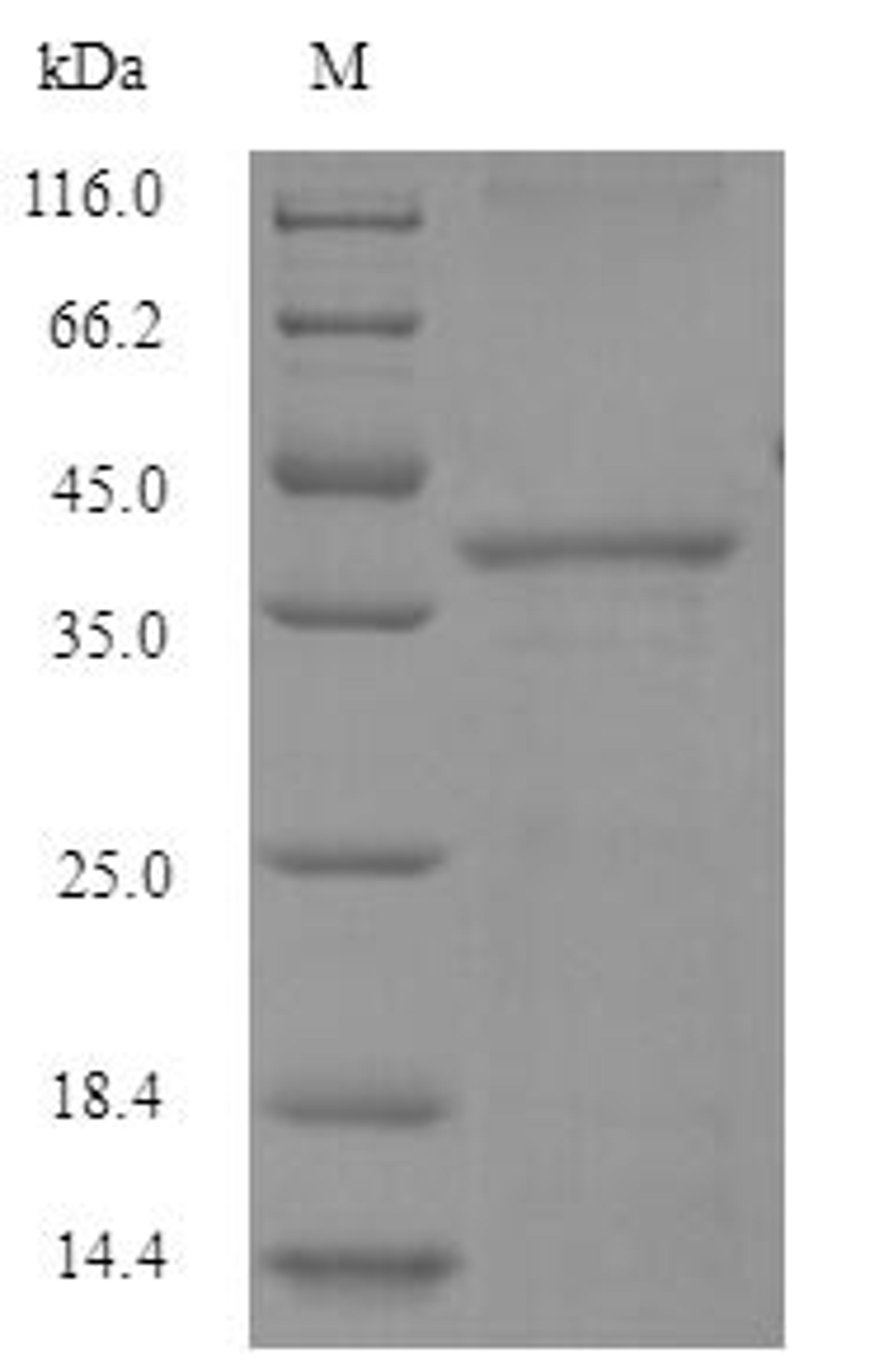 (Tris-Glycine gel) Discontinuous SDS-PAGE (reduced) with 5% enrichment gel and 15% separation gel.