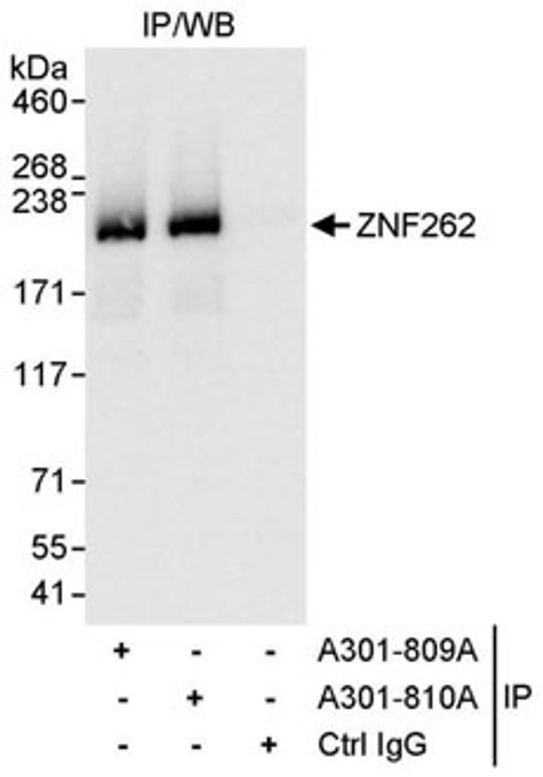 Detection of human ZNF262 by western blot of immunoprecipitates.