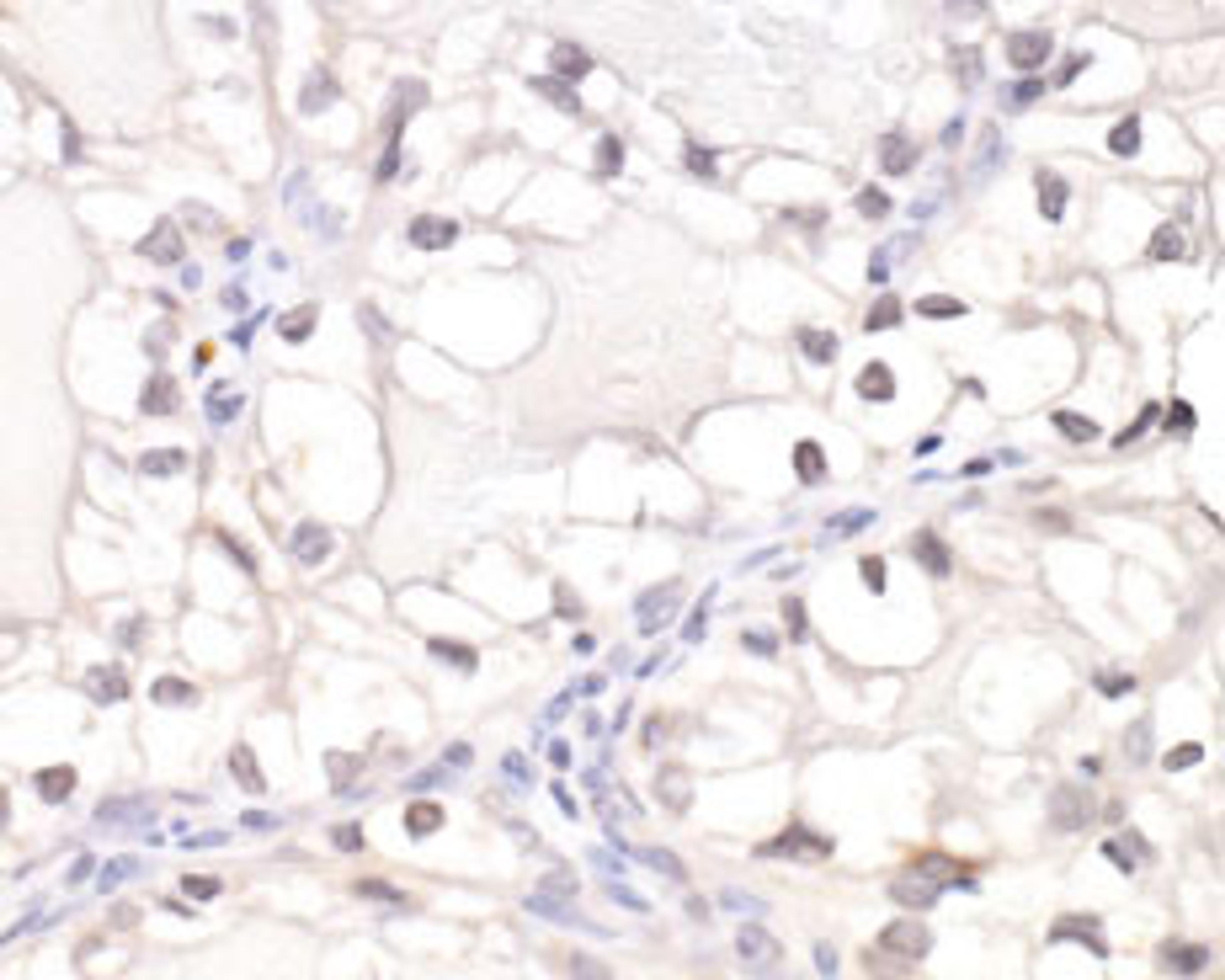 Detection of human HIF1-alpha by immunohistochemistry.