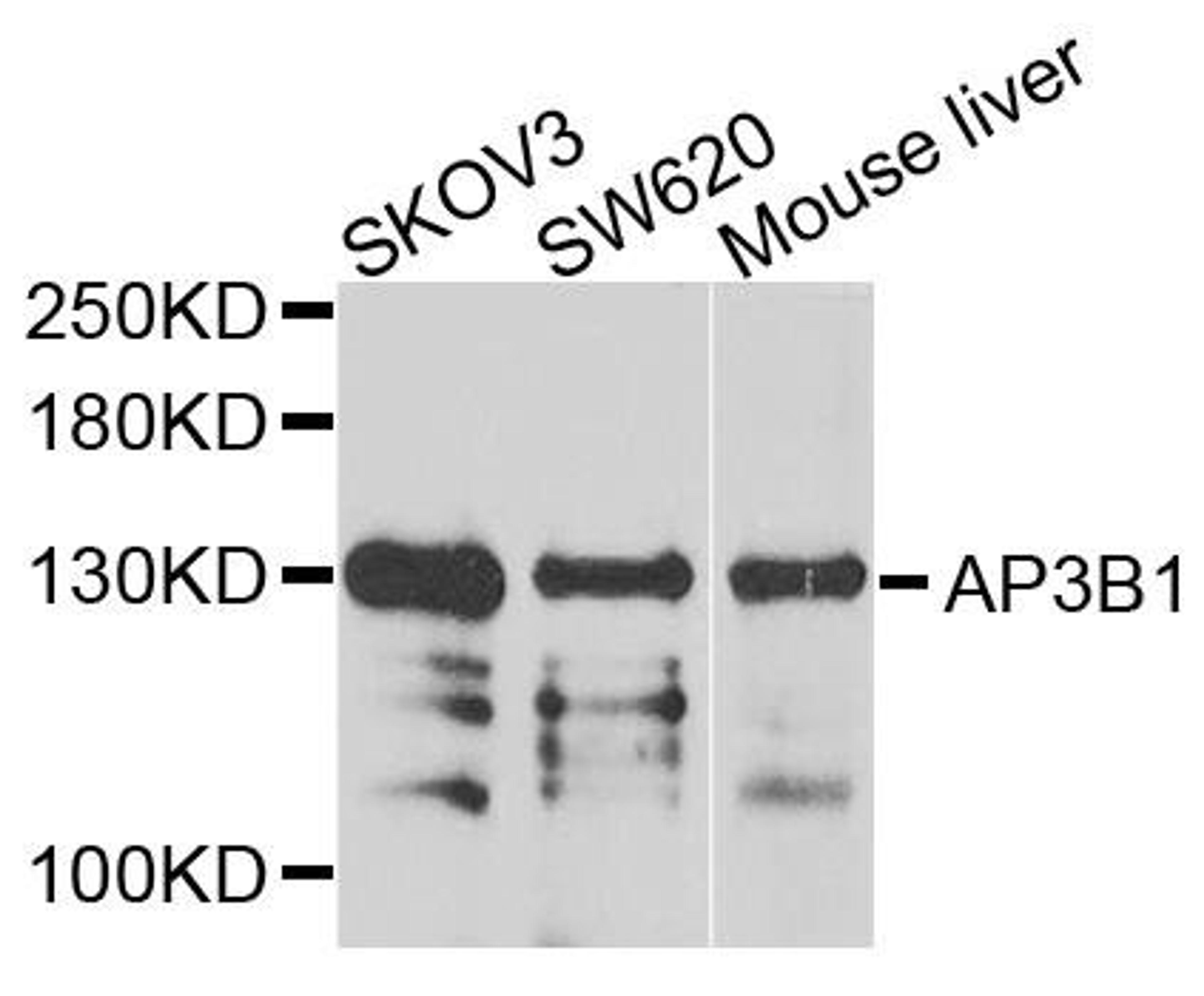 Western blot analysis of extracts of various cells using AP3B1 antibody