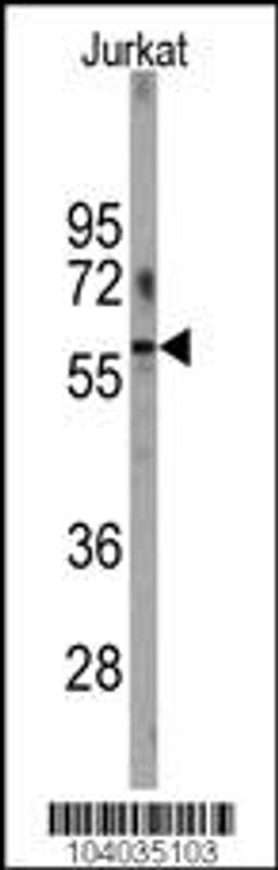 Western blot analysis of anti-PFKFB1 Antibody in Jurkat cell line lysates (35ug/lane).