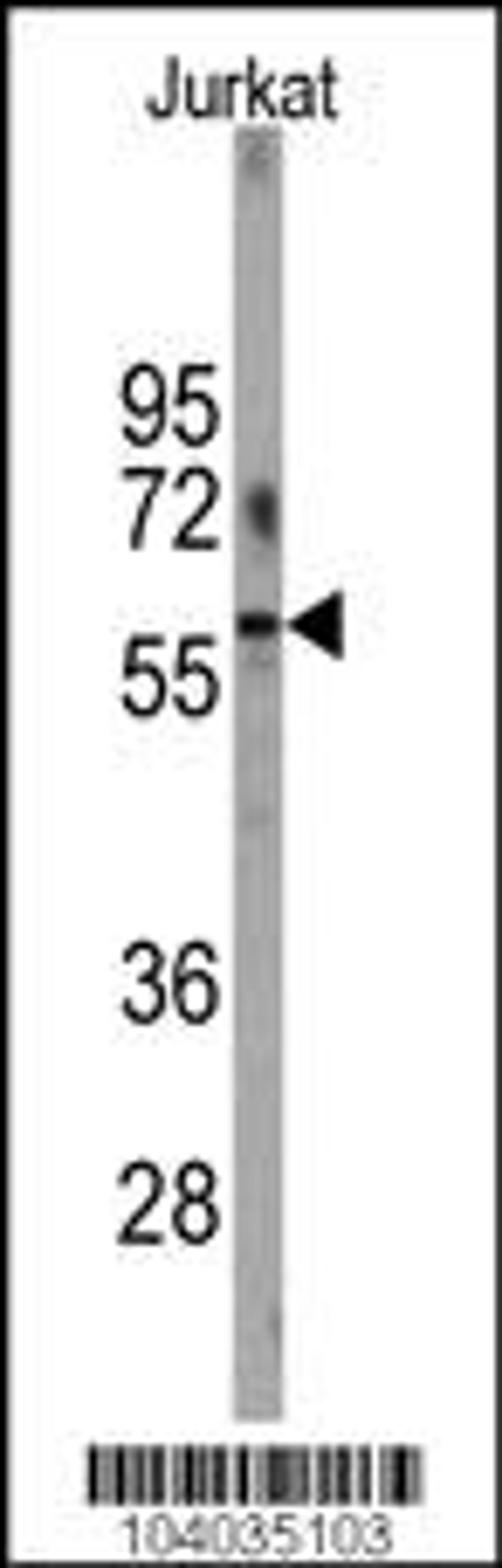 Western blot analysis of anti-PFKFB1 Antibody in Jurkat cell line lysates (35ug/lane).