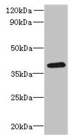 Western blot. All lanes: RSPH14 antibody at 8µg/ml + 293T whole cell lysate. Secondary. Goat polyclonal to rabbit IgG at 1/10000 dilution. Predicted band size: 39 kDa. Observed band size: 39 kDa