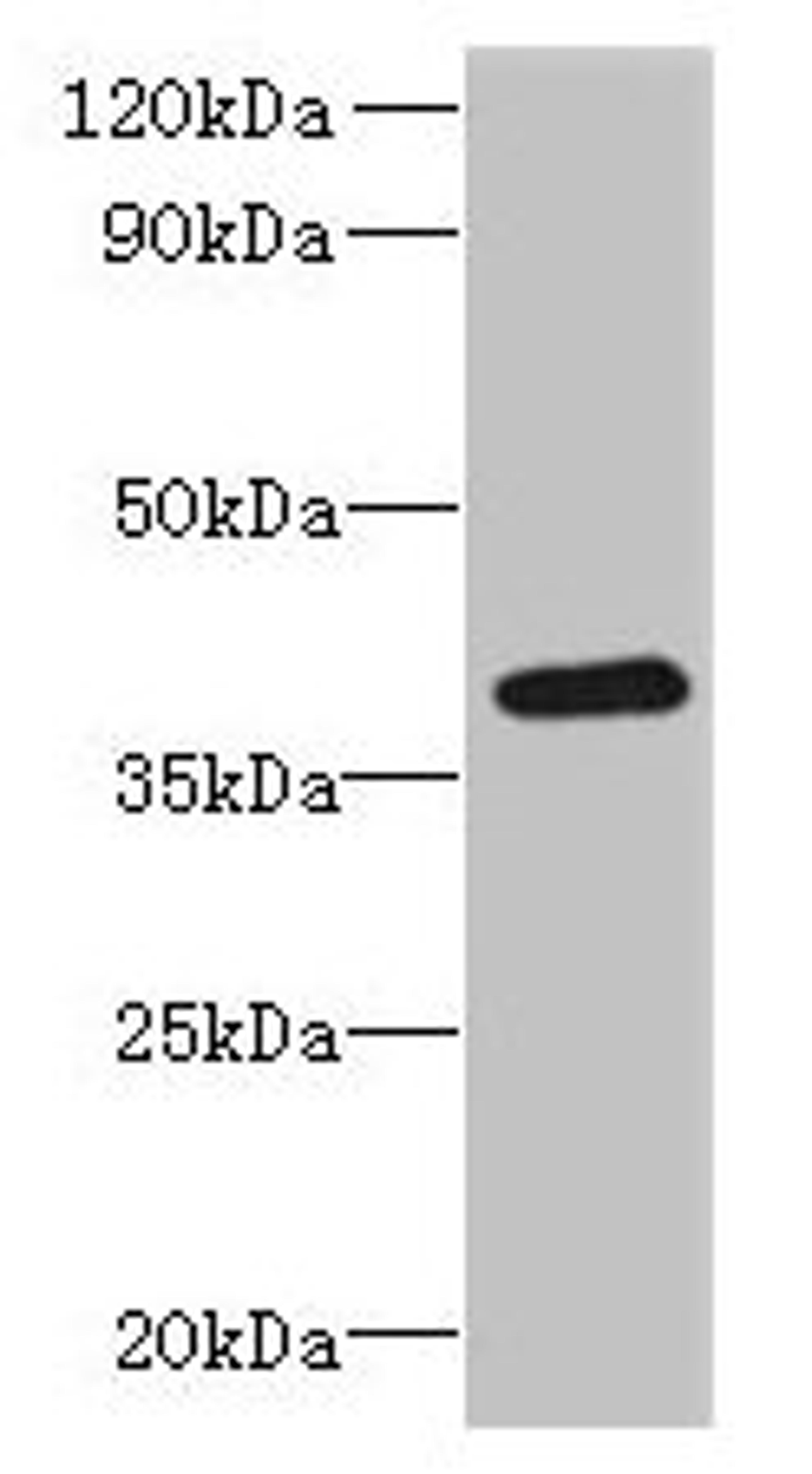 Western blot. All lanes: RSPH14 antibody at 8µg/ml + 293T whole cell lysate. Secondary. Goat polyclonal to rabbit IgG at 1/10000 dilution. Predicted band size: 39 kDa. Observed band size: 39 kDa