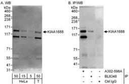 Detection of human KIAA1688 by western blot and immunoprecipitation.