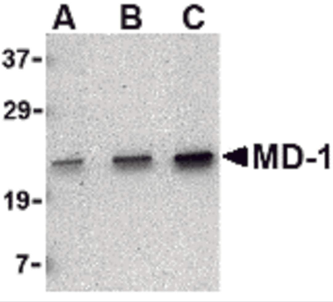 Western blot analysis of MD-1 in Daudi cell lysate with MD-1 antibody at (A) 0.5, (B) 1 and (C) 2 μg/mL.