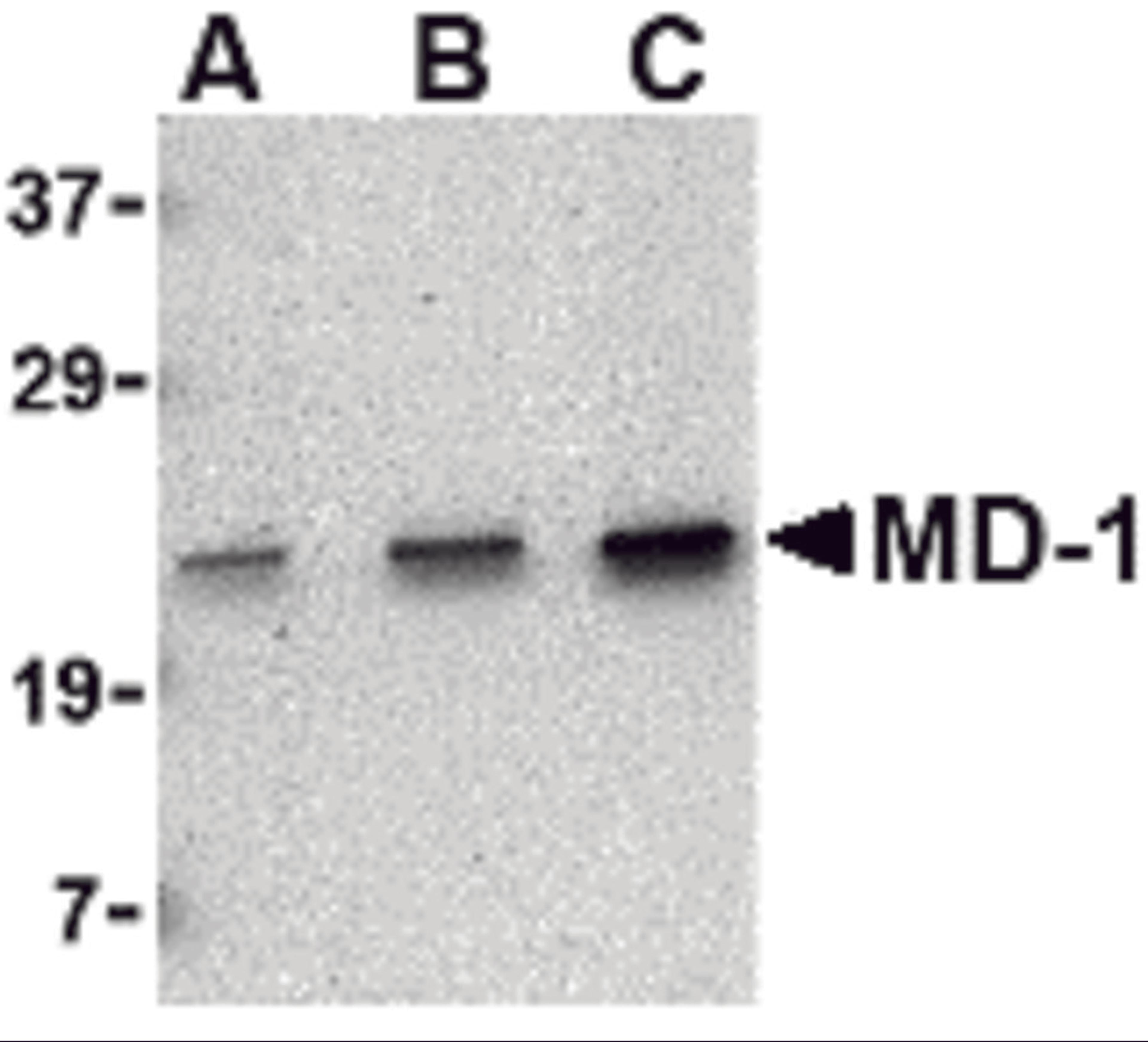 Western blot analysis of MD-1 in Daudi cell lysate with MD-1 antibody at (A) 0.5, (B) 1 and (C) 2 μg/mL.