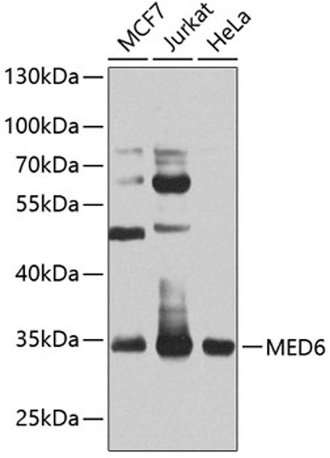 Western blot - MED6 antibody (A8181)