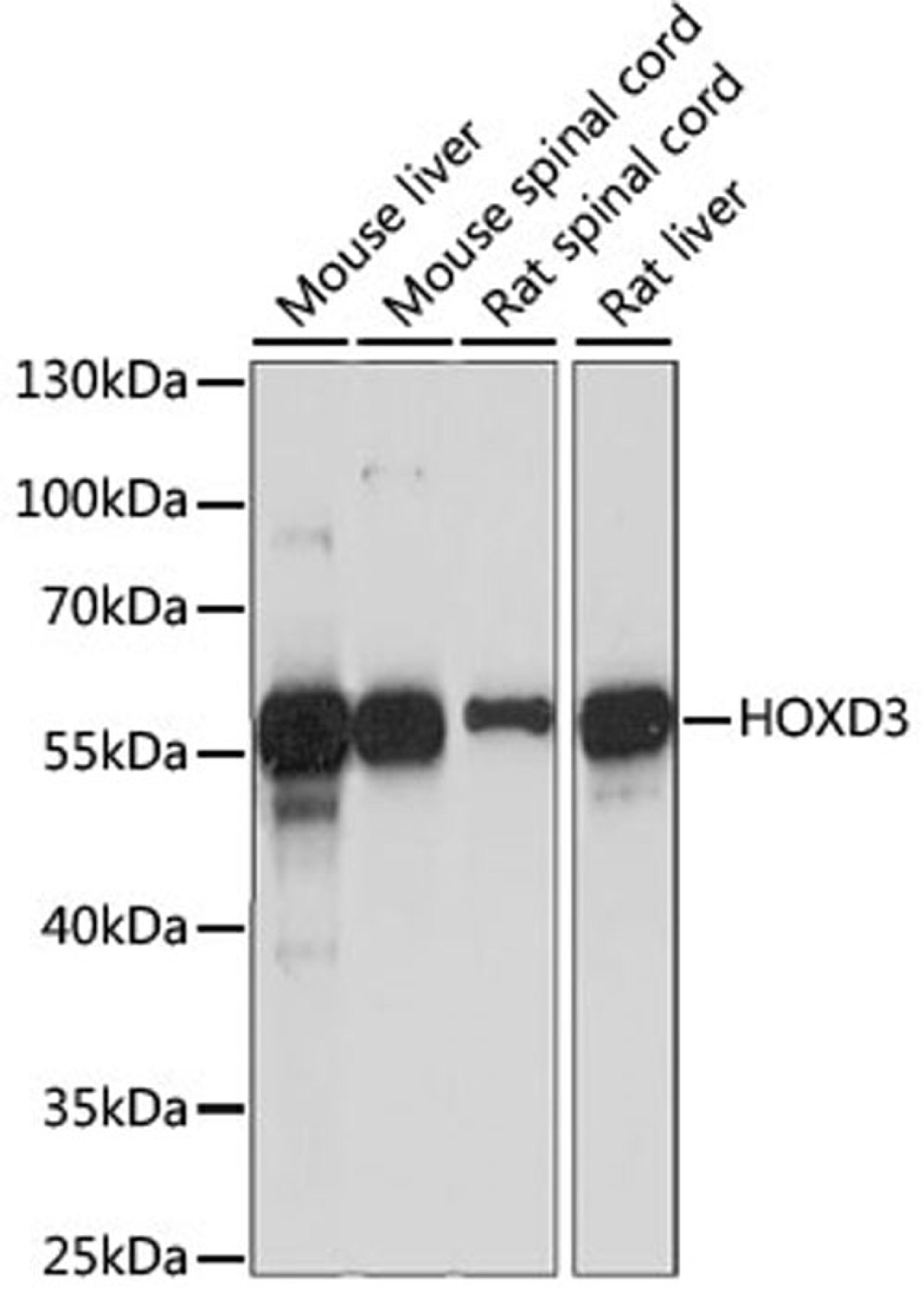 Western blot - HOXD3 antibody (A15279)