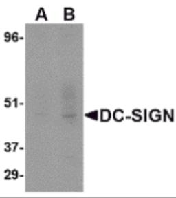 Western blot analysis of DC-SIGN in human placenta tissue lysate at (A) 1 and (B) 2 &#956;g/mL.