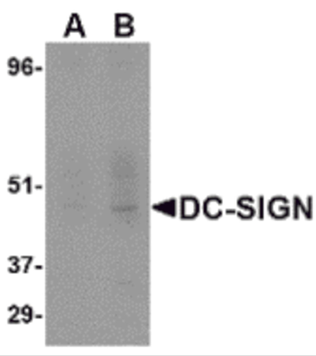 Western blot analysis of DC-SIGN in human placenta tissue lysate at (A) 1 and (B) 2 μg/mL.