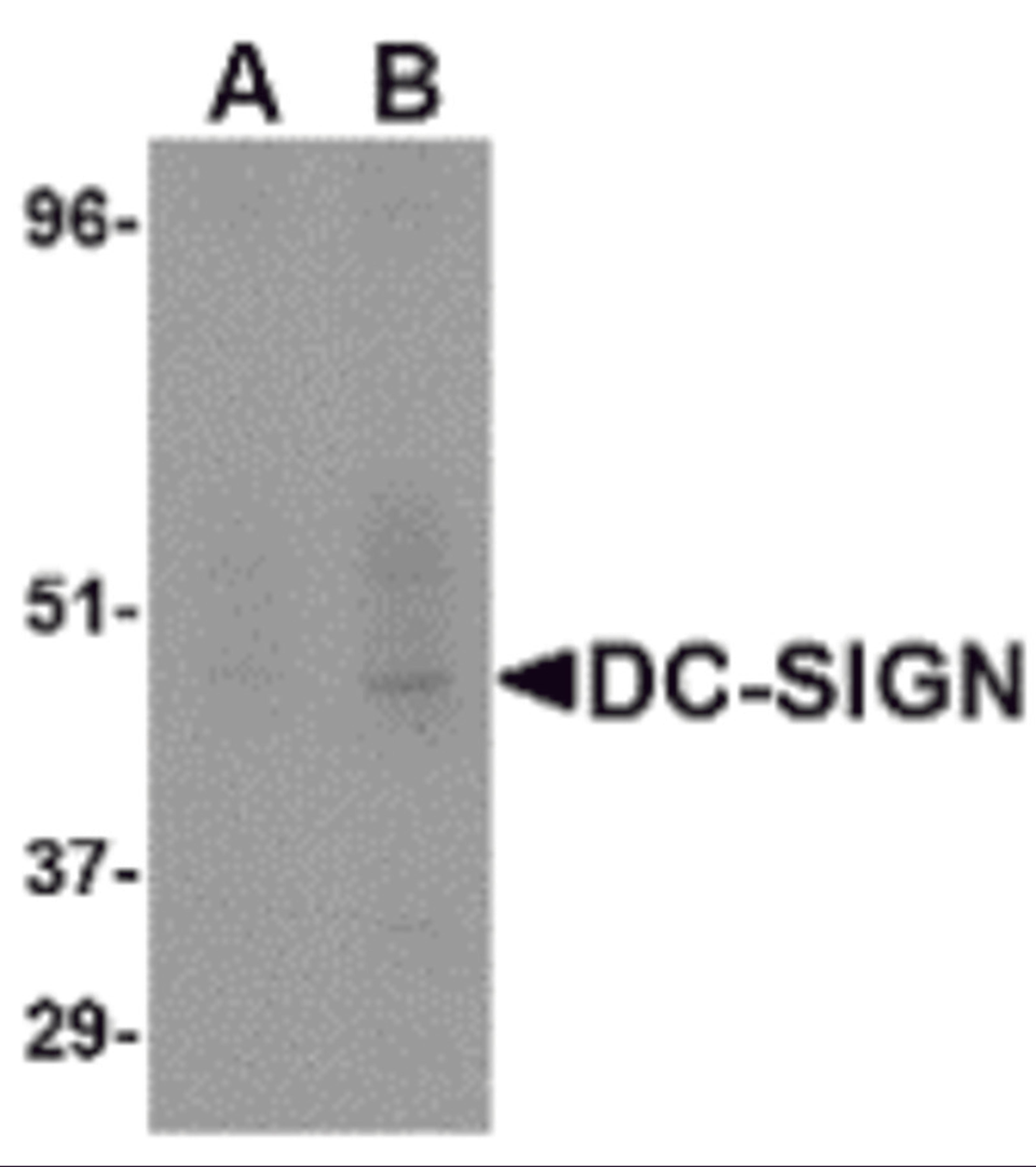 Western blot analysis of DC-SIGN in human placenta tissue lysate at (A) 1 and (B) 2 μg/mL.