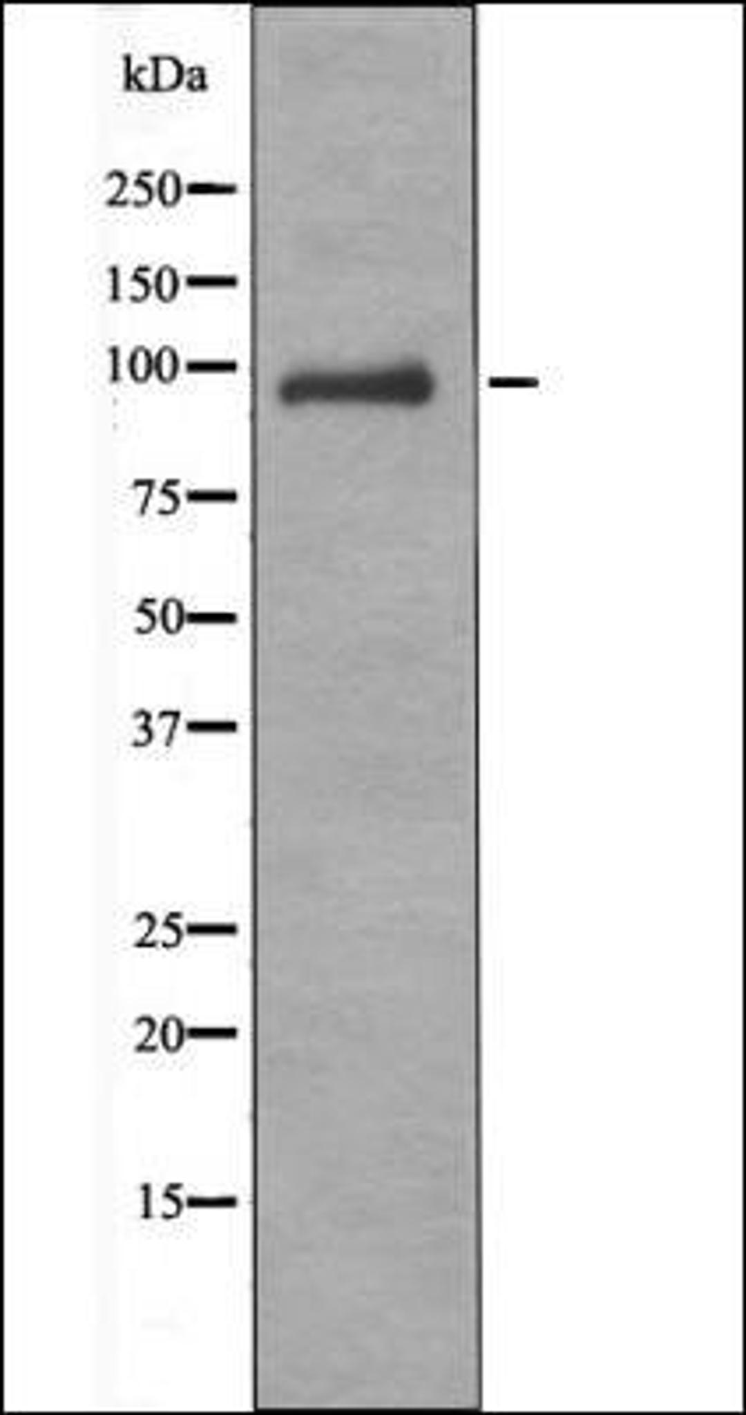 Western blot analysis of A549 whole cell lysates using VAV1 -Phospho-Tyr160- antibody