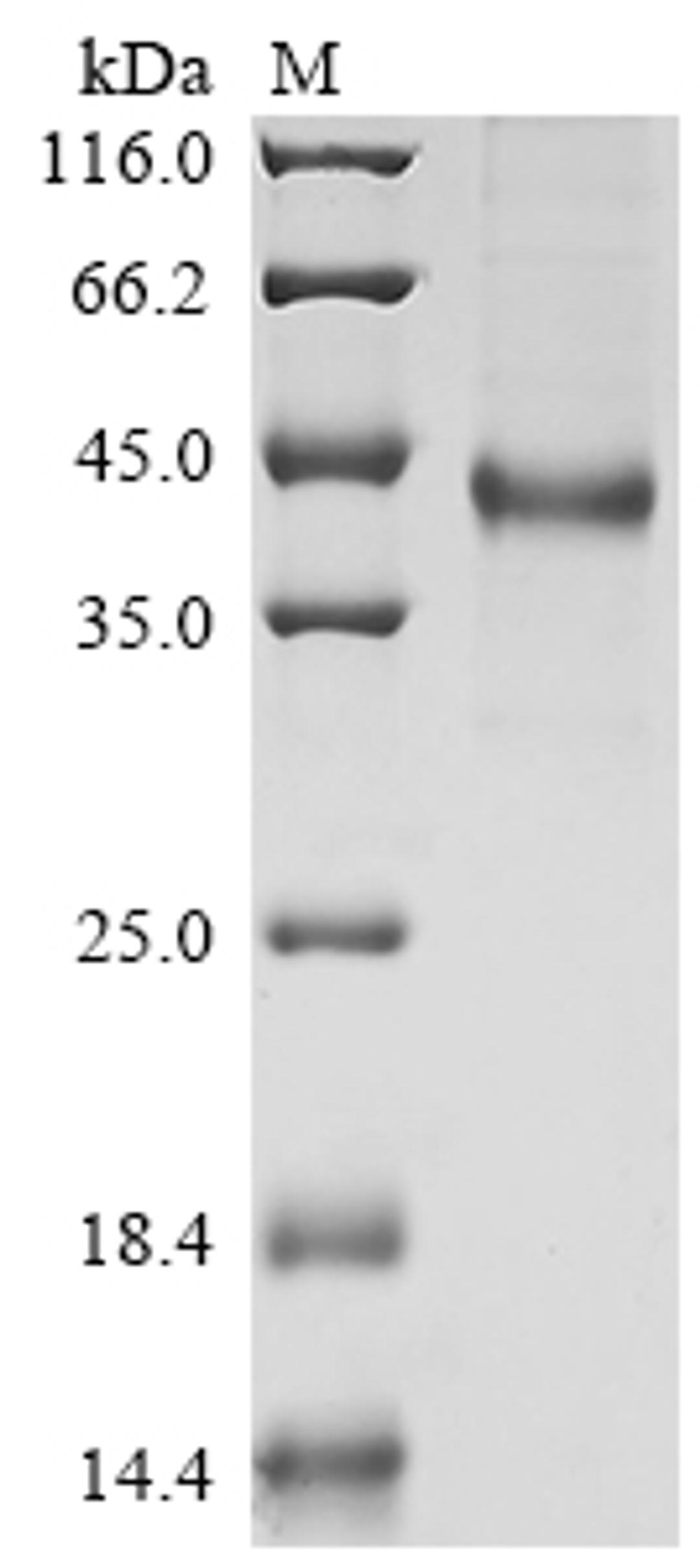 (Tris-Glycine gel) Discontinuous SDS-PAGE (reduced) with 5% enrichment gel and 15% separation gel.