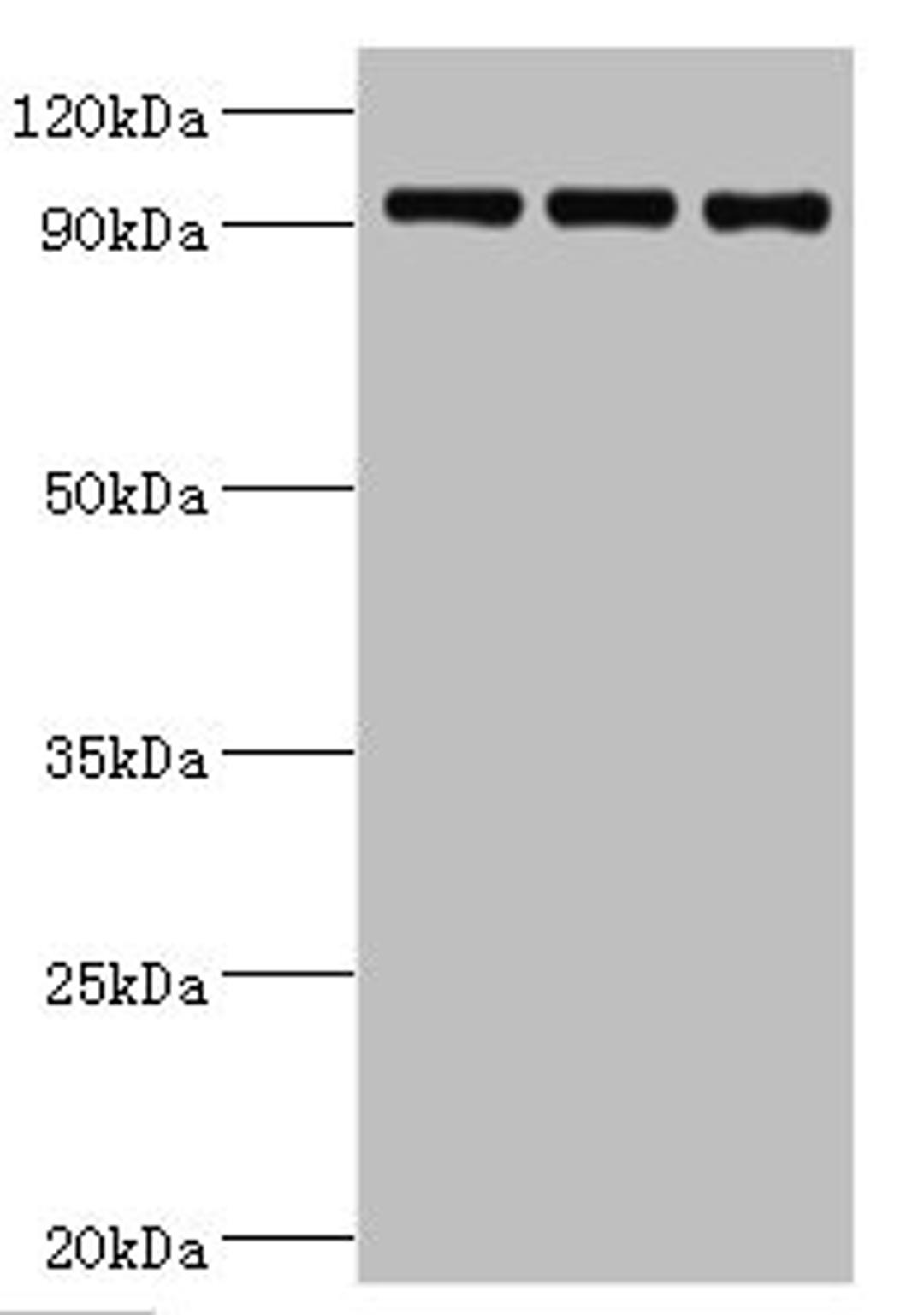Western blot. All lanes: Heat shock protein 105 kDa. antibody at 1ug/ml. Lane 1: MCF-7 whole cell lysate. Lane 2: Hela whole cell lysate. Lane 3: Mouse brain tissue. Secondary. Goat polyclonal to rabbit IgG at 1/10000 dilution. Predicted band size: 97, 93, 98 kDa. Observed band size: 97 kDa.