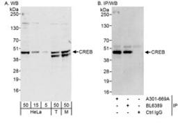 Detection of human and mouse CREB by western blot (h&m) and immunoprecipitation (h).