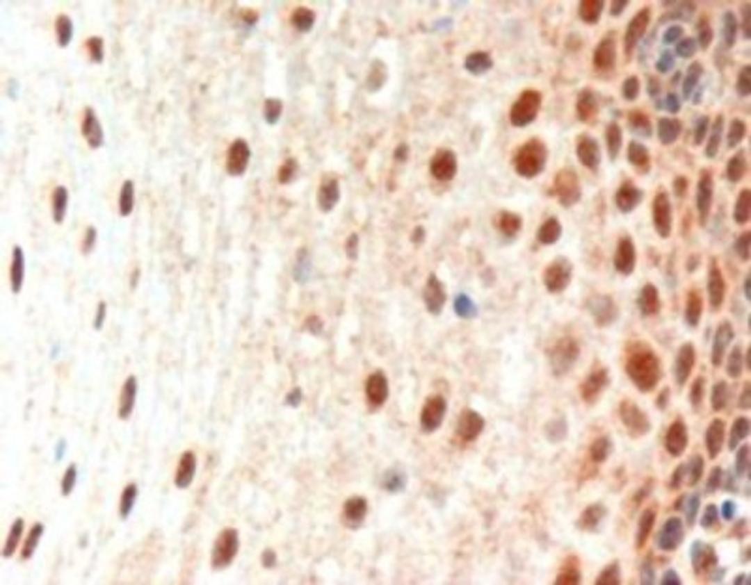 Immunohistochemistry: PAX3 Antibody [NB100-1420] - (3ug/ml) staining of paraffin embedded Human Oesophagus. Microwaved antigen retrieval with Tris/EDTA buffer pH9, HRP-staining.