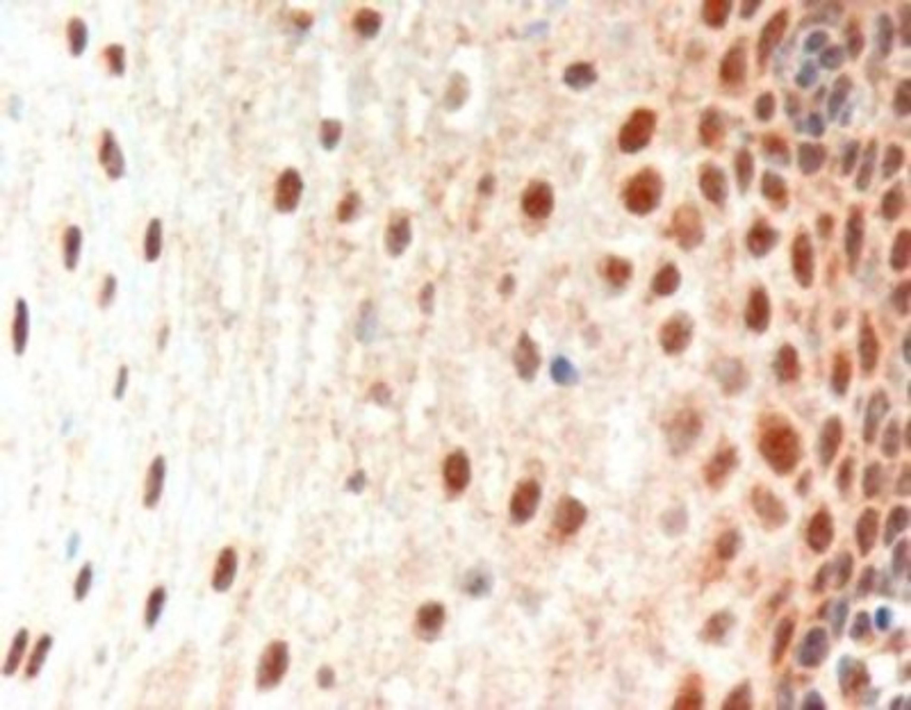 Immunohistochemistry: PAX3 Antibody [NB100-1420] - (3ug/ml) staining of paraffin embedded Human Oesophagus. Microwaved antigen retrieval with Tris/EDTA buffer pH9, HRP-staining.