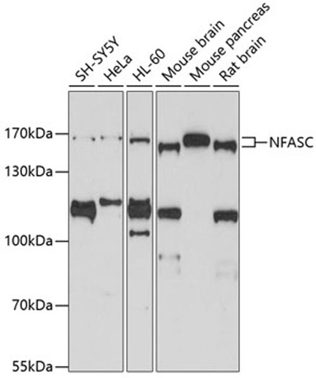 Western blot - NFASC antibody (A3053)