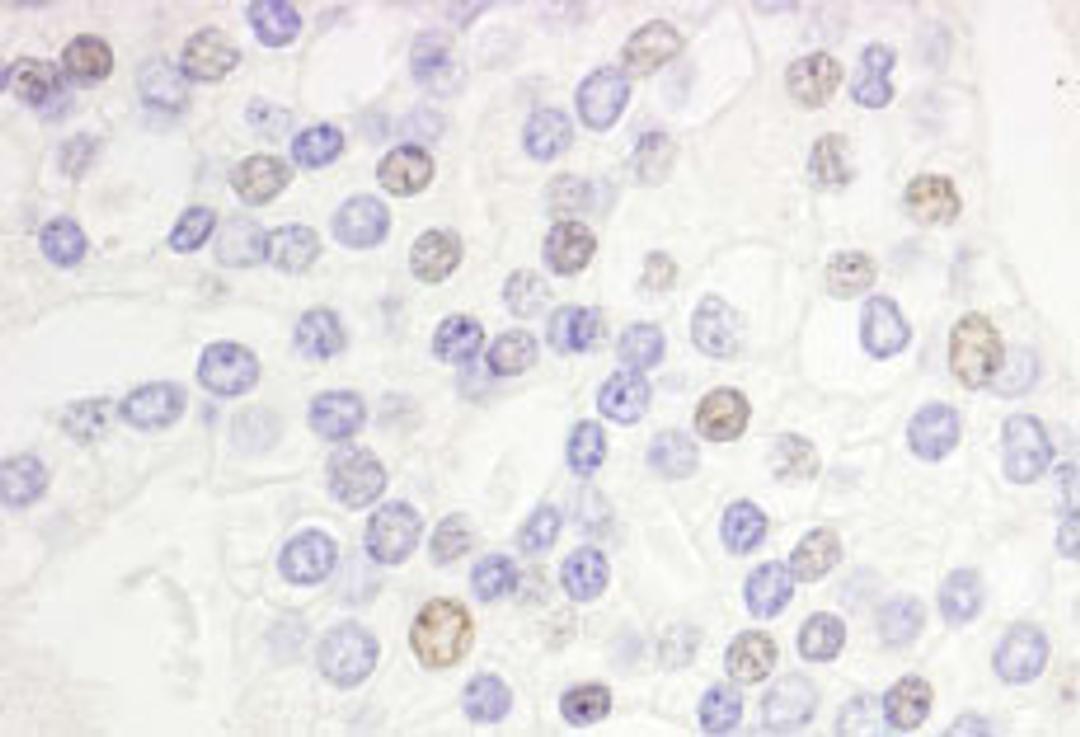 Detection of human DEK by immunohistochemistry.