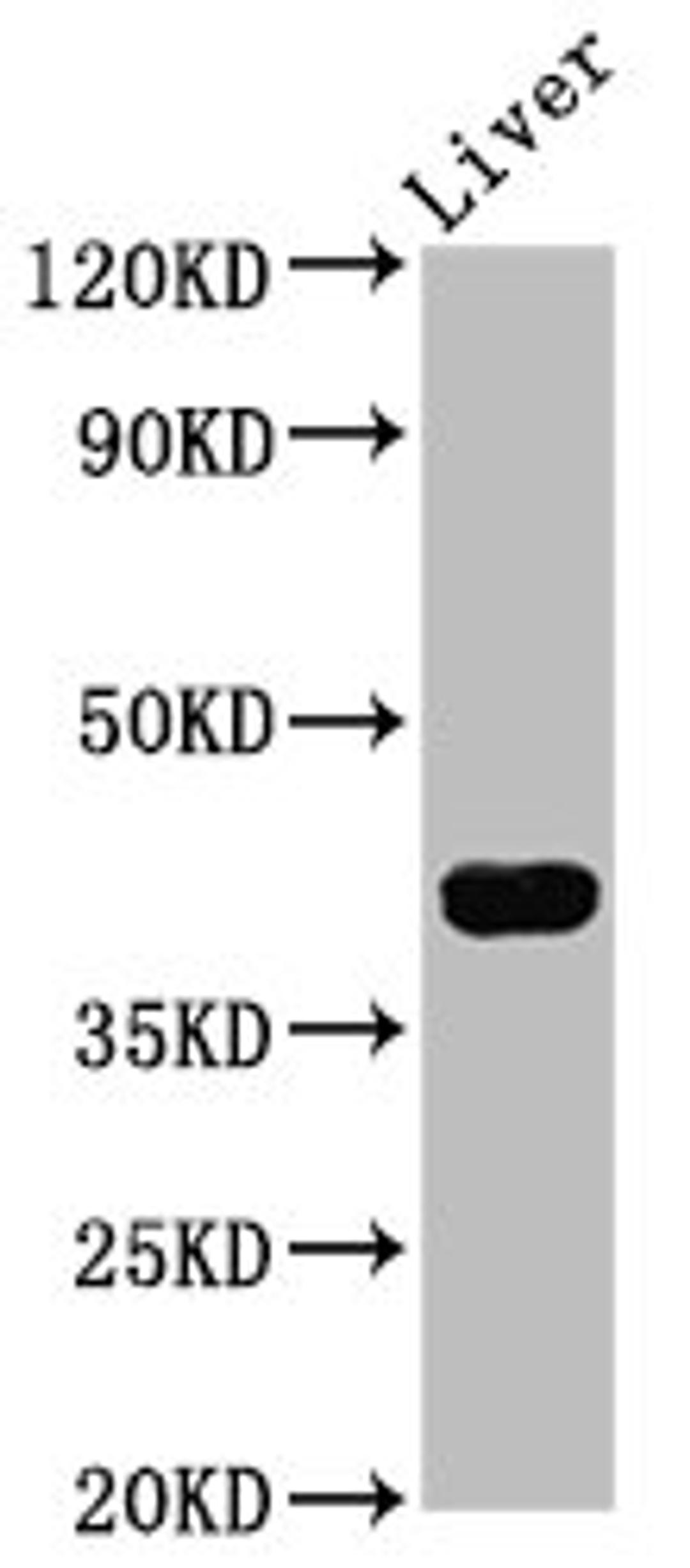 Western Blot. Positive WB detected in: Mouse liver tissue. All lanes: RASSF7 antibody at 4.3ug/ml. Secondary. Goat polyclonal to rabbit IgG at 1/50000 dilution. Predicted band size: 40, 37, 35 kDa. Observed band size: 40 kDa.