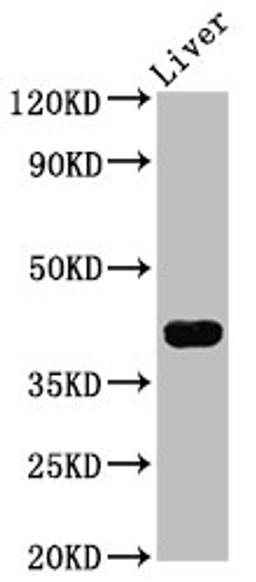 Western Blot. Positive WB detected in: Mouse liver tissue. All lanes: RASSF7 antibody at 4.3ug/ml. Secondary. Goat polyclonal to rabbit IgG at 1/50000 dilution. Predicted band size: 40, 37, 35 kDa. Observed band size: 40 kDa.