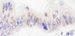 Detection of human JMJD2A by immunohistochemistry.