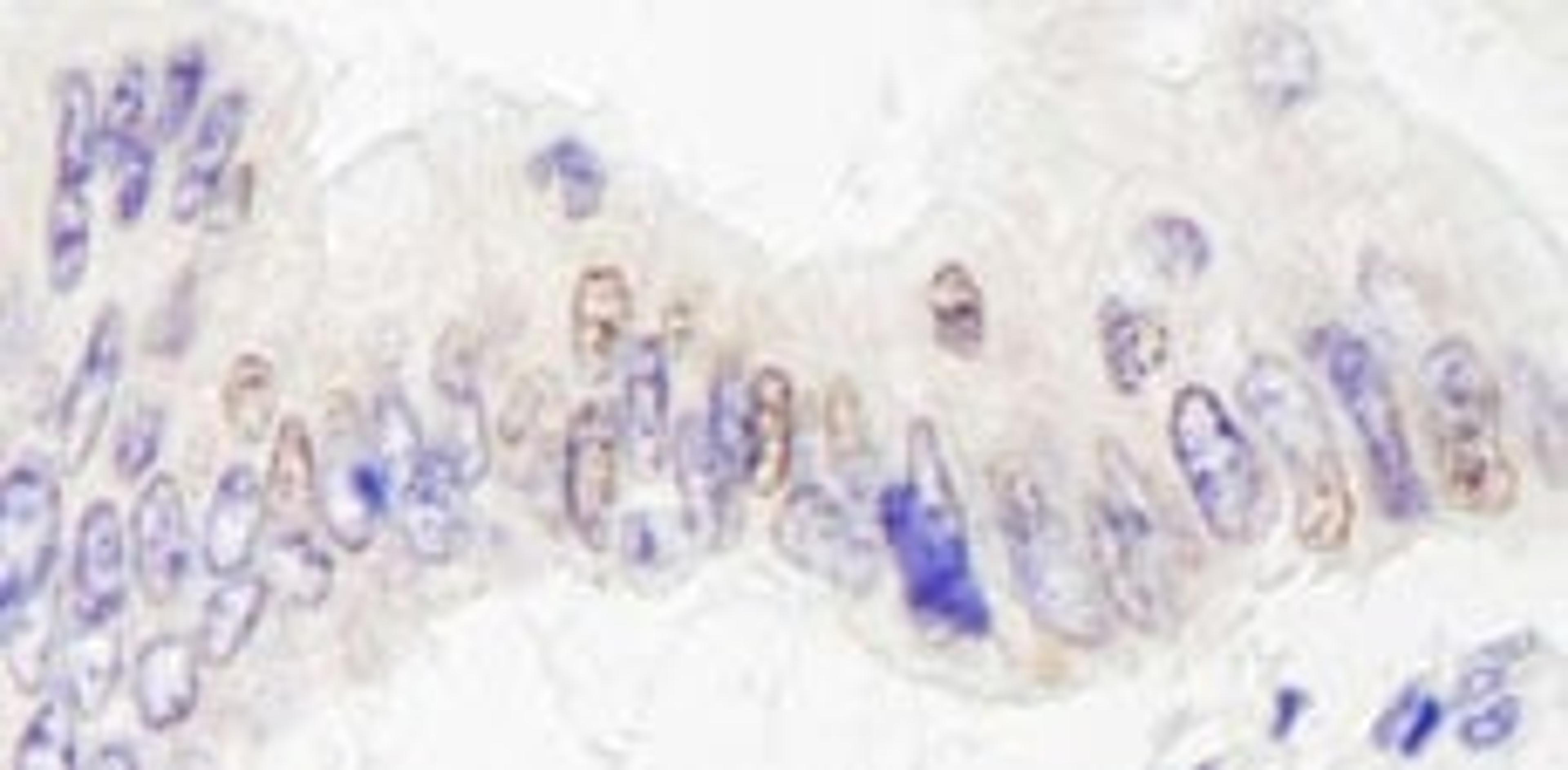 Detection of human JMJD2A by immunohistochemistry.