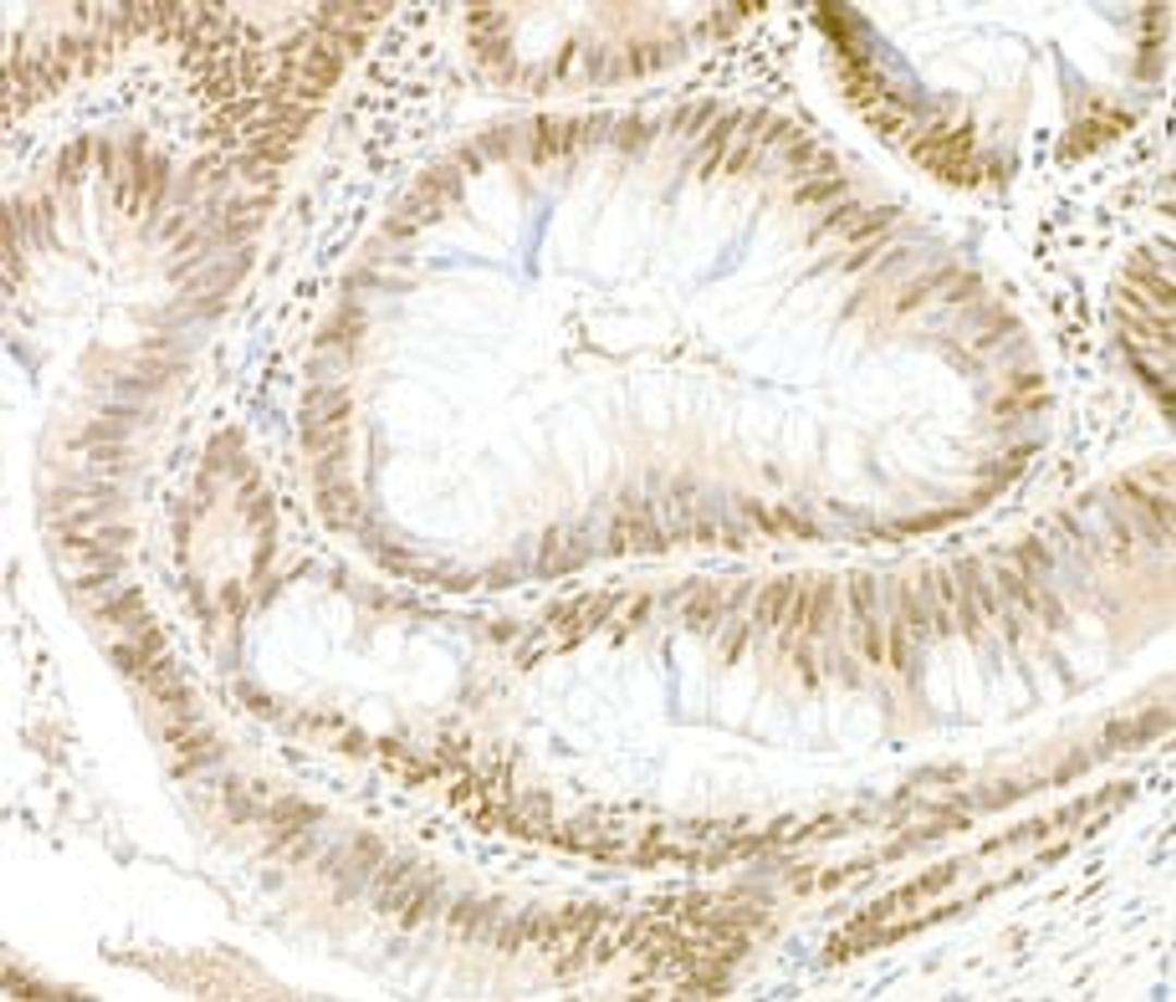 Detection of human GAPDH by immunohistochemistry.