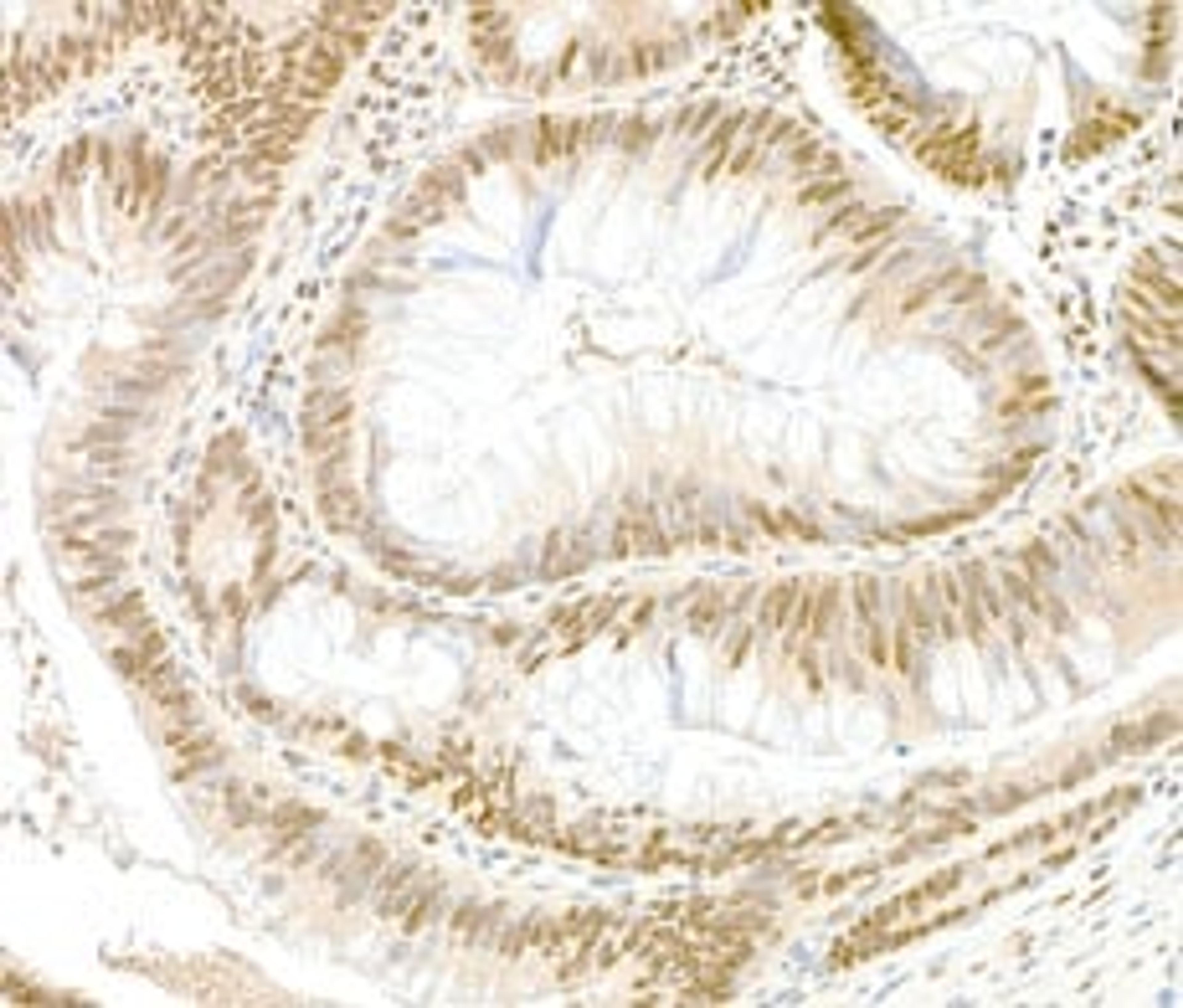 Detection of human GAPDH by immunohistochemistry.